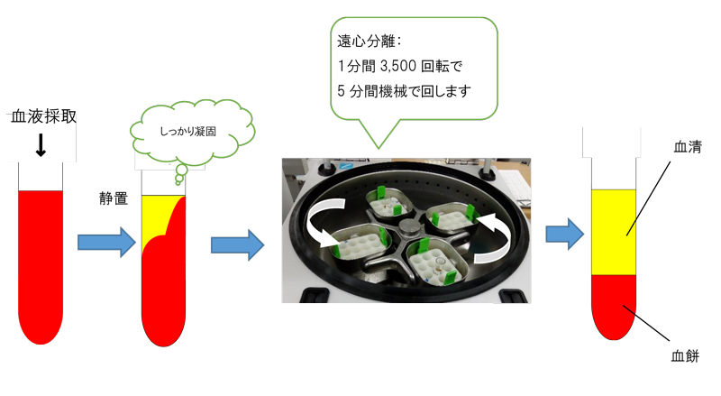 血液 血清 血漿 について 高岡市医師会